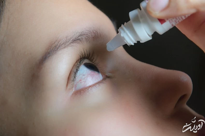 نکات مهم در هنگام آلودگی هوا